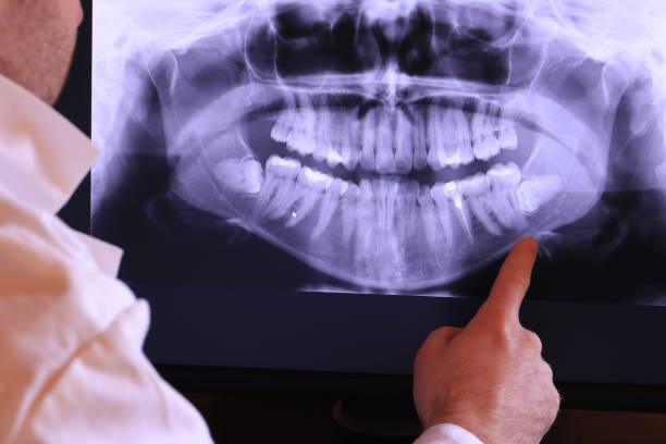 Best Chipped Tooth Repair Near Me  in River Edge, NJ